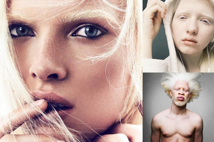 Модели-альбиносы, произведшие фурор в мире моды