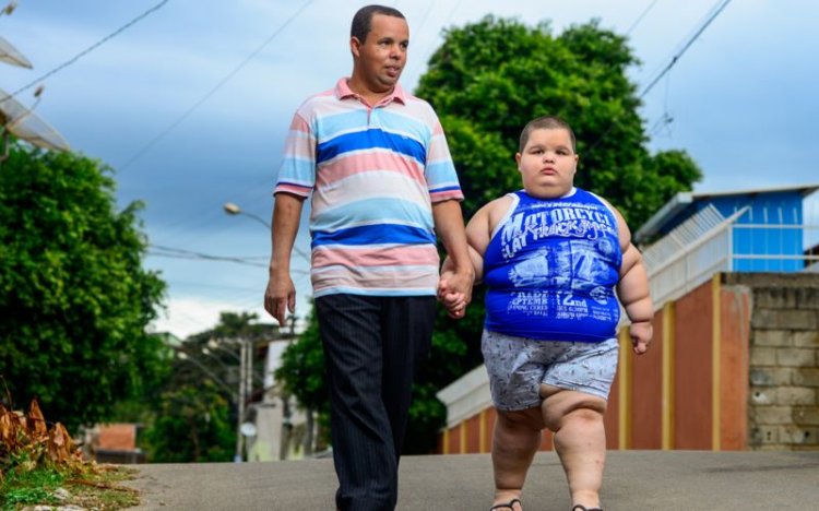 Пятилетний мальчик весит 80 килограмм