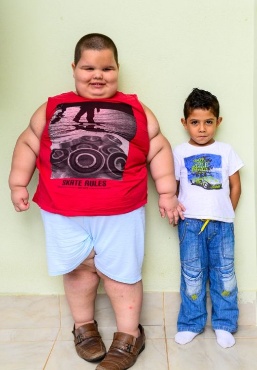 Пятилетний мальчик весит 80 килограмм