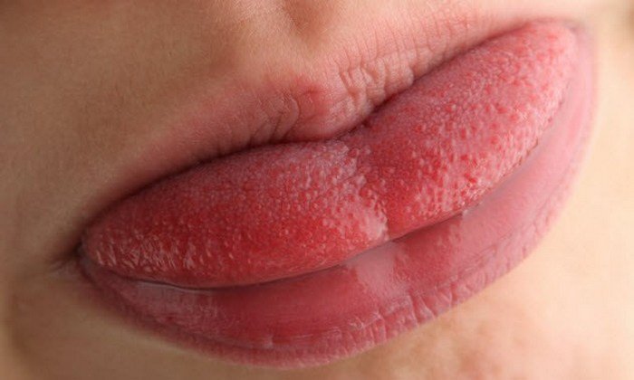 Любопытные факты про человеческий рот, о которых не пишут в школьных учебниках
